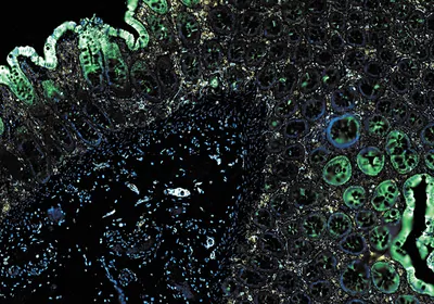 The Power of ChipCytometry™? Multiplexing